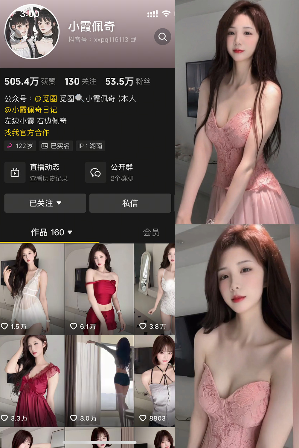 抖音 小霞佩奇 微密圈  NO.007期 【5P1V】最新至：2025.5.2